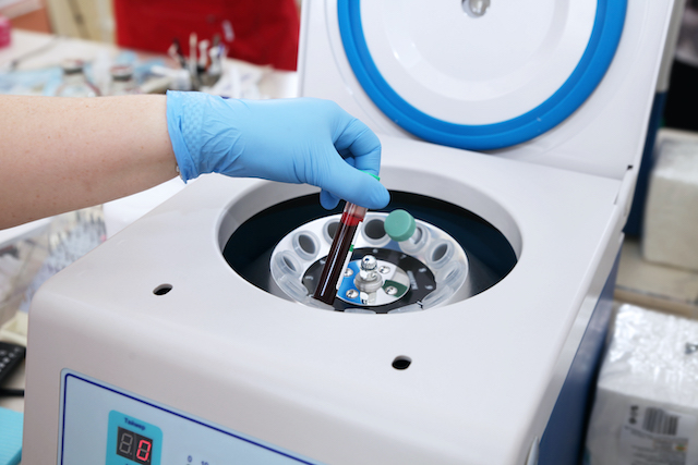 Tube of blood is placed in a medical centrifuge for plasma lifting. Precision centrifuge calibration services are essential.